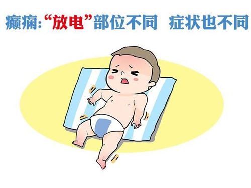 儿童癫痫发作对大脑有影响吗?|经颅磁刺激仪